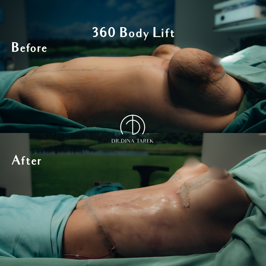 Before - 2026-05-02T053952.017